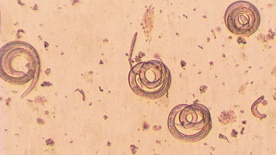 Parasites in Food and Water: Cyclospora Infection